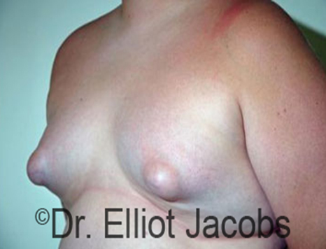 puffy nipples beach michelle gellar puffy nipples beach