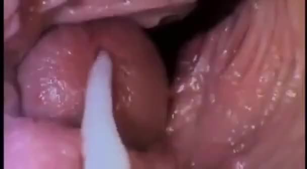 Best of Camera inside vulva