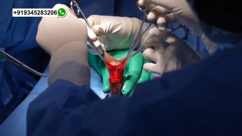 allucard draculla recommends old man penile implant videos porn pic