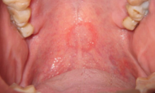 Doctor Fellatio facial scrub ashton stotts recommends Doctor Fellatio