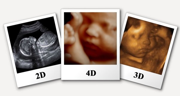 3d pregnancy porn - sky lopez porn dominatrix wrestling