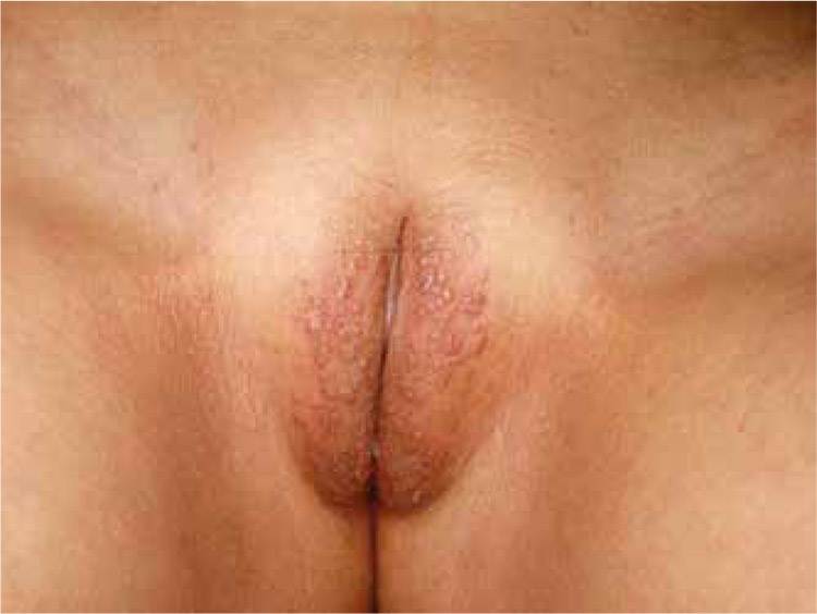 Best of aj guevarra's gallery fat handjob ayin yin add photo veronica vulva