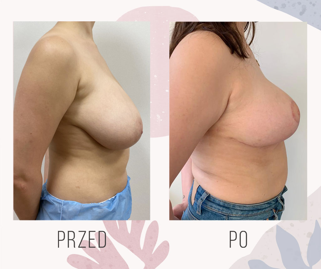 david vodden recommends big polish titties pic