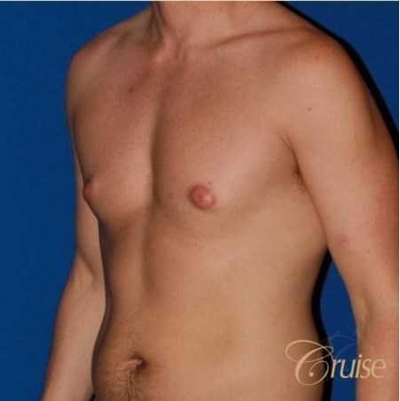 dianne zamora recommends puffy nipples beach david nunley add puffy nipples beach photo