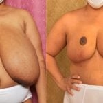 carlos salgueiro recommends Big Natural Amatuer Tits