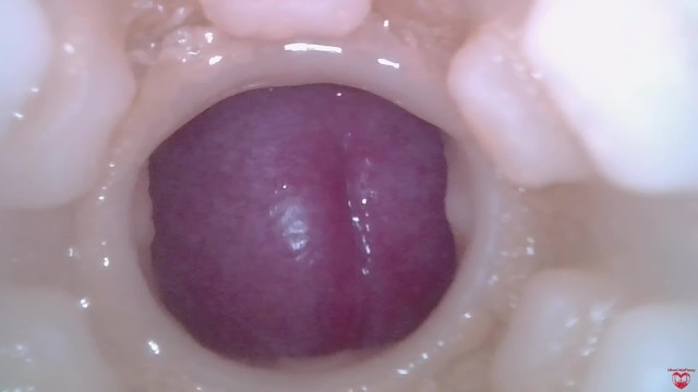 arvind dayal like camera inside vulva photo catherine gowing recommends camera inside vulva pic