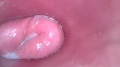 ann hutcheson like camera inside vulva photo clara kang recommends camera inside vulva pic