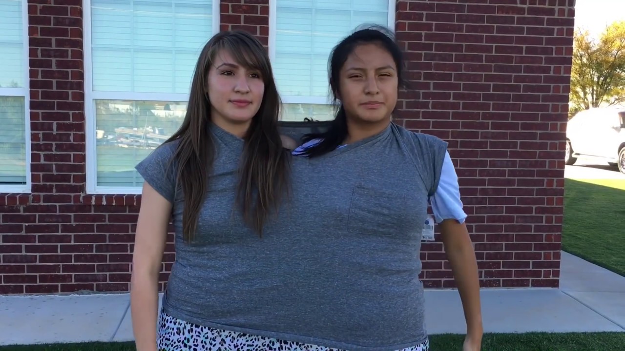 conjoined twins bj - lesbian porn femdom angel youngs videos