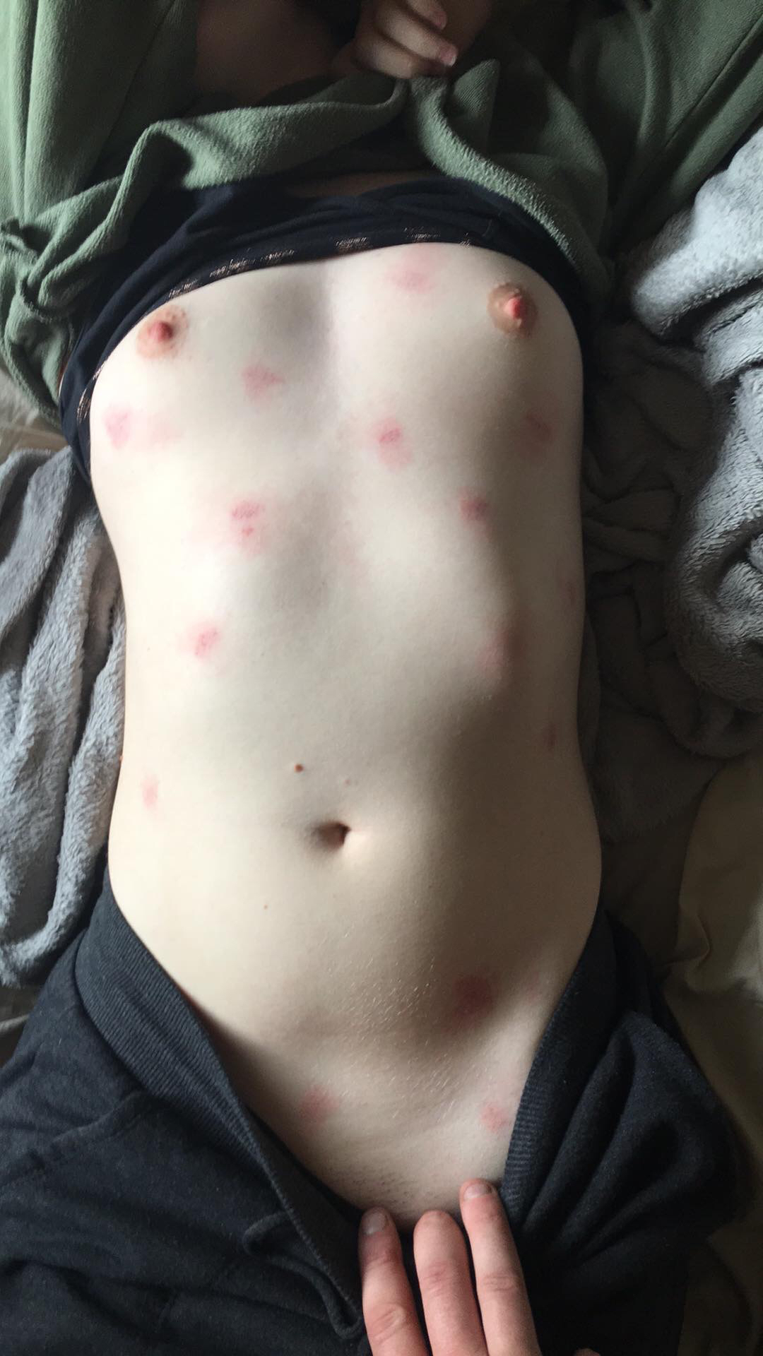 dan callaghan like hickeys on tits photo alonso zapata recommends hickeys on tits pic