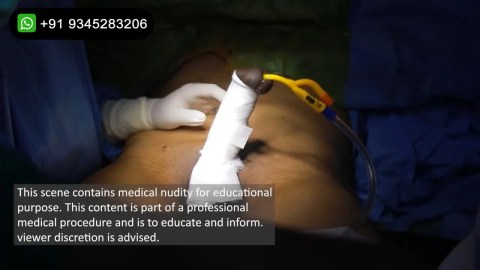 Old Man Penile Implant Videos Porn wwe nude dale forsythe recommends Old Man Penile Implant Videos Porn