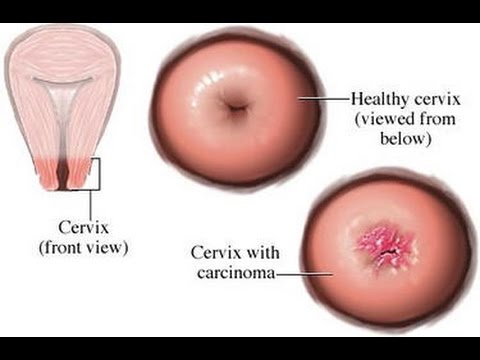 Best of playgirl porn ben lowenstein share pound her cervix photos