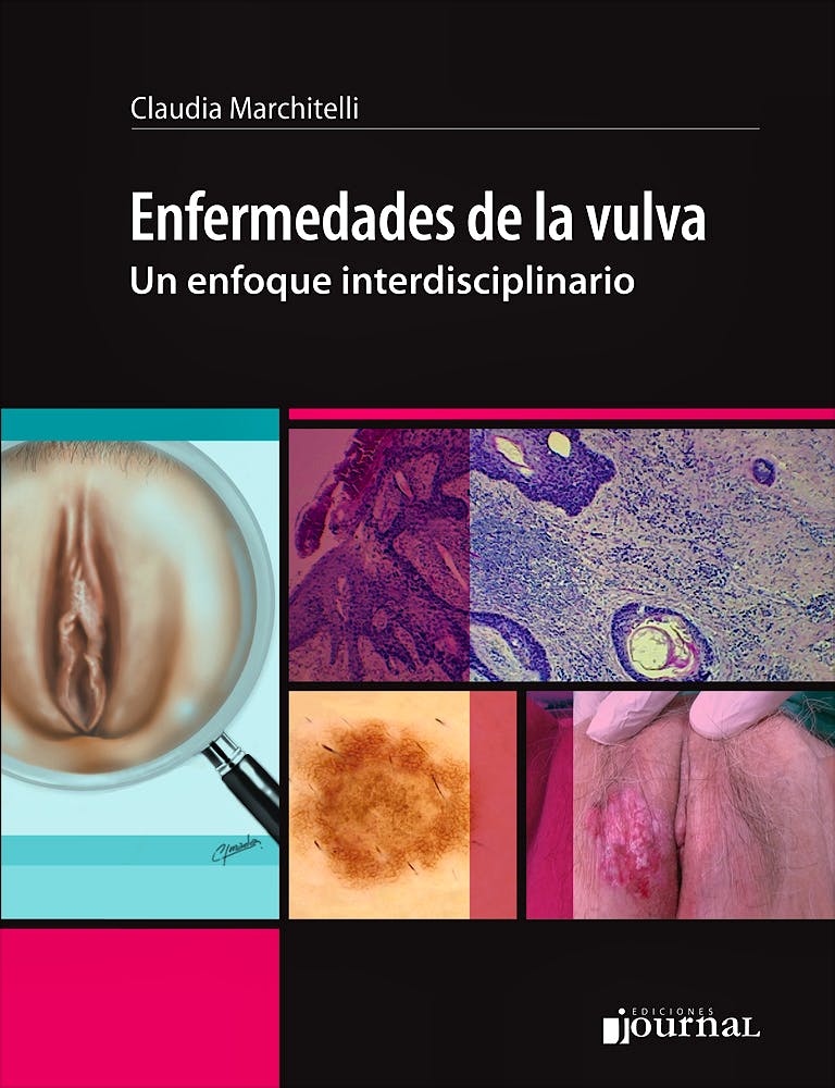 Best of Veronica vulva